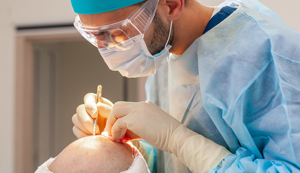 Direct Hair Implantation (DHI)