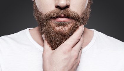 FUE Beard Transplant