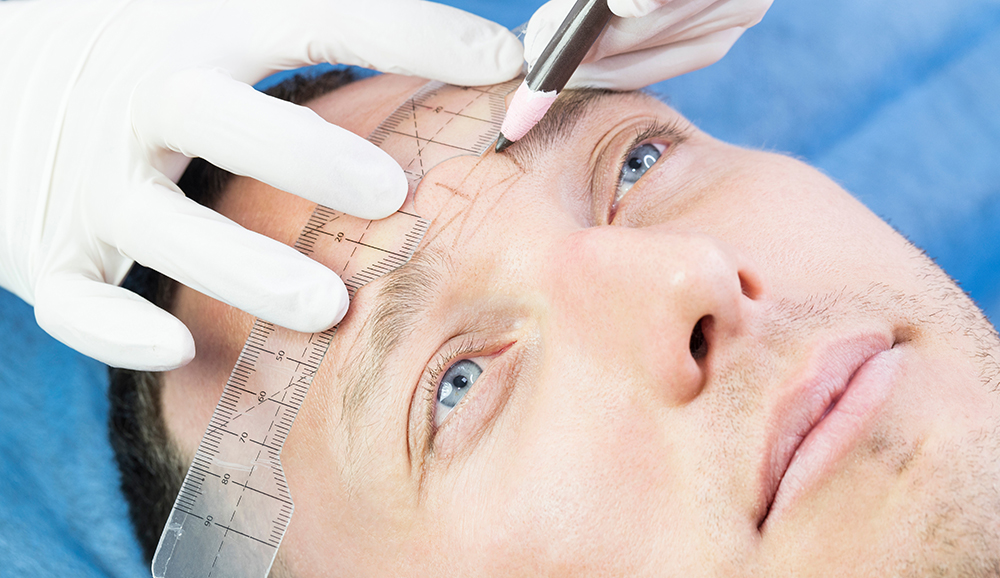 FUE Eyebrow Transplants