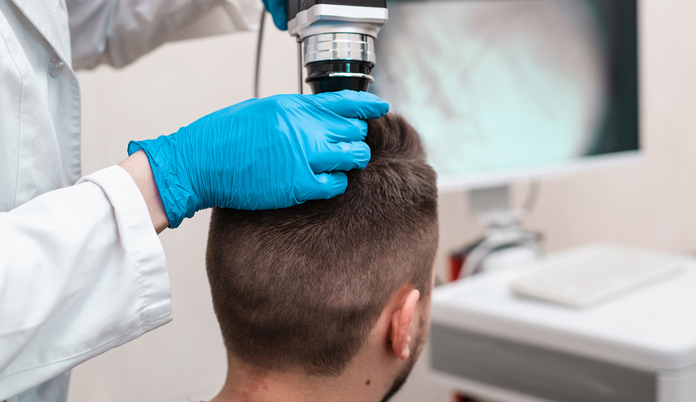 Microcamera scalp and hair analysis